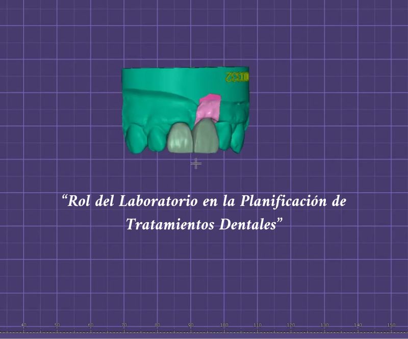 Rol del Laboratorio en la Planificación de Tratamientos Dentales